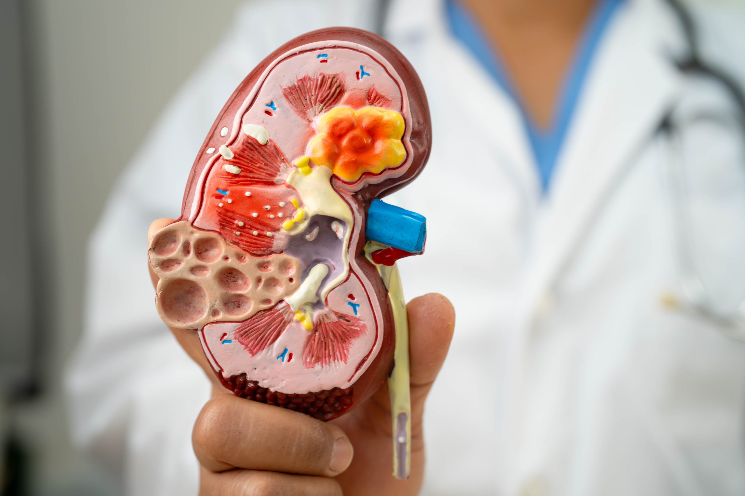 Doença renal crônica